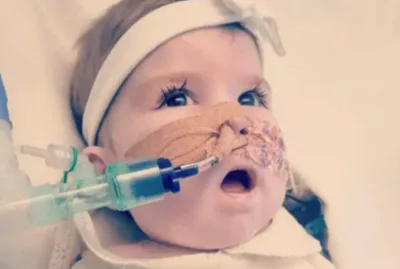 Bebê morre após governo ordenar retirada de suporte de vida