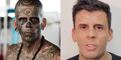 Homem mais tatuado do Brasil que se converteu remove tatuagens do rosto: \"É sobre Jesus\"