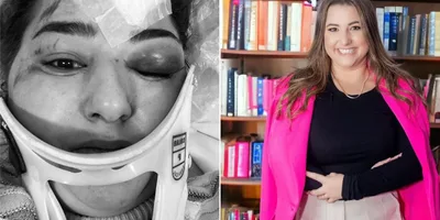 Psicóloga sobrevive a acidente em parque e impressiona médico: \"Verdadeiro milagre\"