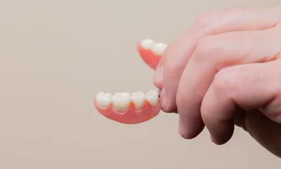 Leucoplasia: o que as manchas brancas dizem sobre sua saúde