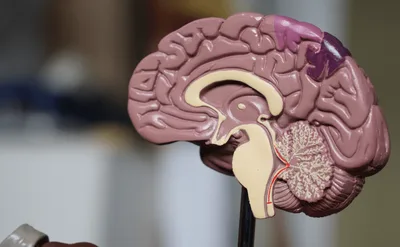 Pesquisadores israelenses desativam tumor cerebral
