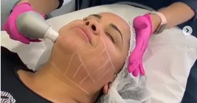 Cassiane ganha tratamento estético de Simone e resultado é incrível