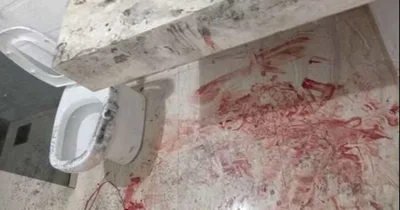 Pastor esfaqueia garota de programa em motel