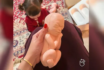 "O aborto não elimina o parto": Líderes comentam caso de menina grávida após estupro