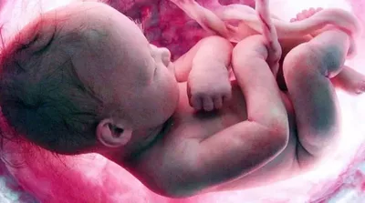 Supremo dos EUA está prestes a revogar a legalização do aborto no país