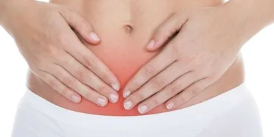 Mitos e verdades sobre o mioma em mulheres