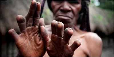 Missionário supera o risco de morte para evangelizar canibais