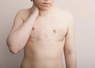 Cirurgiões Plásticos se opõe a cirurgias em menores "trans"