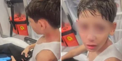 Menino cristão sofre ataque com spray de pimenta durante o Dia da Expiação em Israel