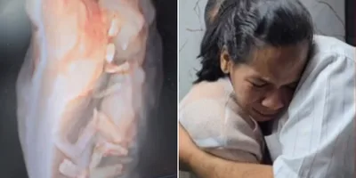 Após laqueadura, mulher engravida e relata milagre: \"Deus tem um propósito\"
