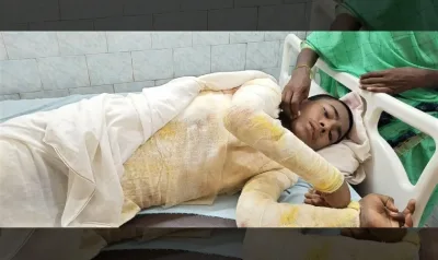 Morre menino cristão que teve 65% do corpo queimado em ataque