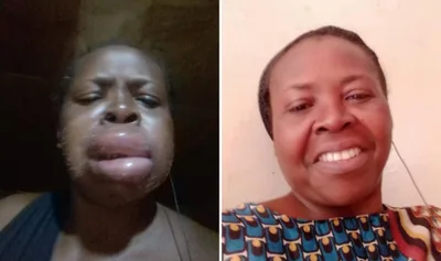 Tubérculo venenoso quase mata mulher, que foi curada após oração