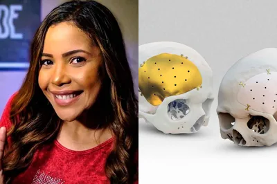 Exclusivo: Amanda Wanessa esperou dois meses por prótese craniana