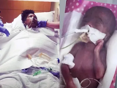 Após dias de cirurgia, mãe e bebê sobrevivem pelas orações: "Senti um exército lutando"