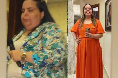 Helena Raquel relembra o antes e depois da cirurgia que a fez perder quase 50 quilos