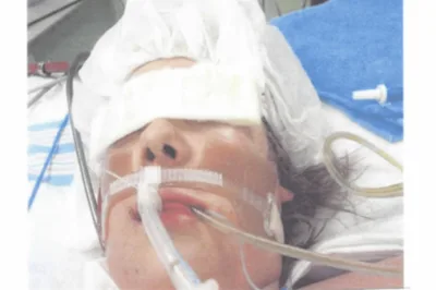 Adolescente voltou à vida após ficar uma hora sem oxigênio