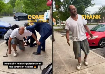 Homem tem perna instantaneamente curada após receber oração