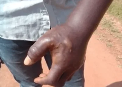 Evento evangelístico em Uganda tem mais de 20 cristãos agredidos