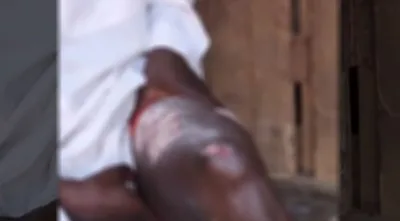 Diretor de escola é demitido e queimado após ser flagrado orando a Jesus