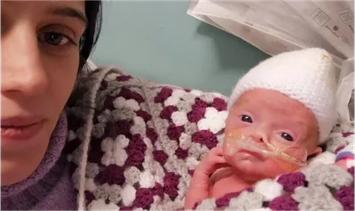 Bebê que foi declarado morto no útero volta à vida e surpreende