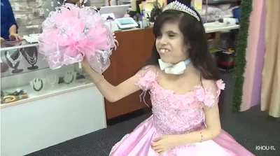 Menina que viveria apenas 20 dias celebra 15 anos após oração da mãe
