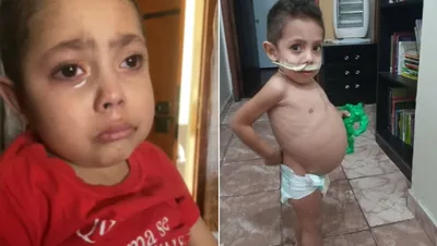 Com doença rara, criança faz desabafo: 'Eu não tenho esperança'