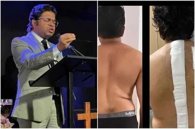 Impactante: Veja o antes e o depois da cirurgia do pastor Nilson Gomes