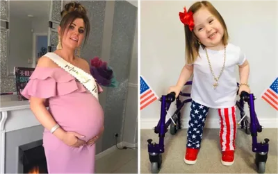 Mãe é pressionada para abortar bebê com deficiência, mas ela nega