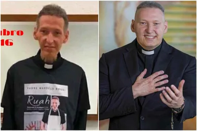 Padre Marcelo Rossi alerta sobre a depressão, mostrando imagens de antes e depois