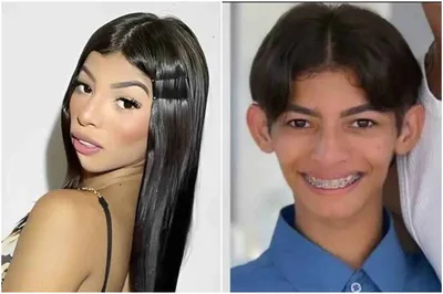 Ex-trans anuncia a retirada das próteses de silicone após aceitar Jesus
