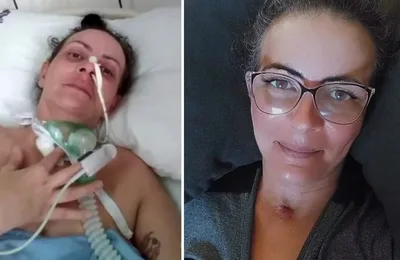 ‘Vi uma Rocha coberta de sangue’, diz mulher que sobreviveu após 72 dias na UTI com Covid