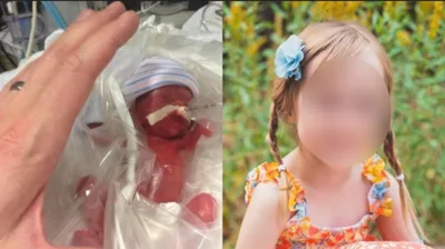 Bebê sobrevive a complicações médicas após pais recusarem aborto: \"Escolhemos a vida\"