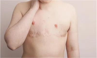'Experimento deu errado', diz jovem arrependida ao mudar de sexo