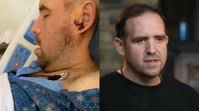 Motorista do Uber sobrevive a tiro na cabeça durante assalto: ‘Orei a Deus’