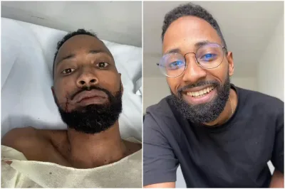 Assessor de Samuel Messias é baleado na bochecha em tentativa de assalto