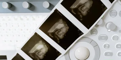 Irlanda registra quase 11 mil abortos e estabelece novo recorde em 2024