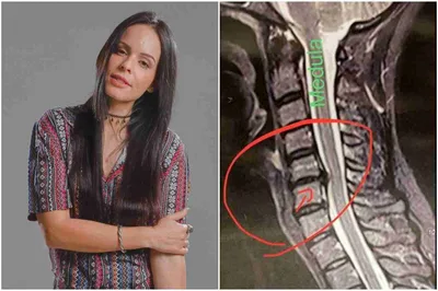 Cantora gospel Marcela Taís vai se submeter a cirurgia na coluna
