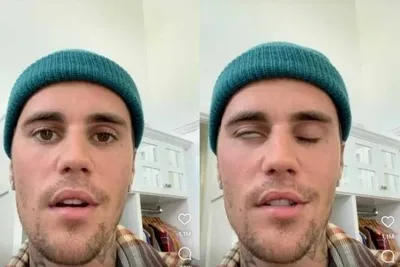 Justin Bieber pede orações ao revelar paralisia facial
