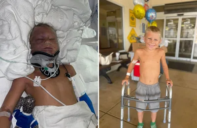 "Deus é bom": Criança de 6 anos sobrevive após ser atropelada por trator