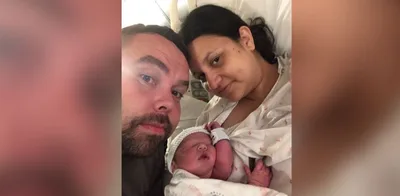 Casal se recusa abortar bebê com deformidade e vive milagre: "Não nos curvamos ao aborto"