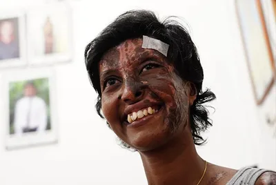 Cristã sobrevive a ataque com explosão dentro de igreja no Sri Lanka: ‘Só pensei em Jesus’
