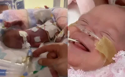 Bebês nascidos com apenas 22 semanas sobrevivem após oração