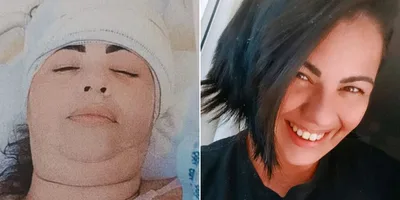 \"Foi o começo do meu propósito com Deus\", diz cristã curada de câncer no cérebro