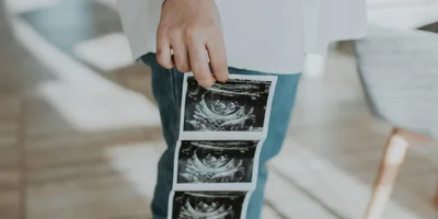 Escócia registra recorde histórico em números de abortos
