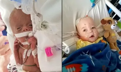 Bebê declarado morto por médicos volta à vida; ‘Foi milagre’, disse a mãe