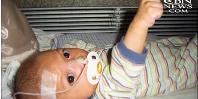 Bebê é curado de um tumor na boca após igrejas se unirem em oração
