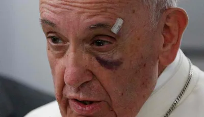 Pope says he hopes Trump reconsiders DACA decision