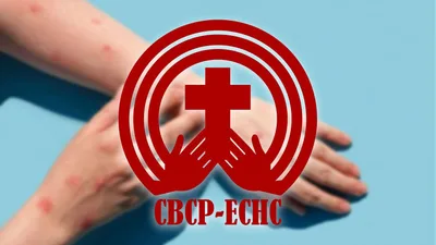Mamamayan, binalaan ng CBCP-ECHC sa pagkalat hg fake news sa MPOX virus