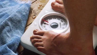 Malnutrition at obesity, patuloy na tumataas sa bansa - VeritasPH