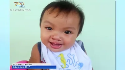 New Year, New Smile for Baby Jhorex